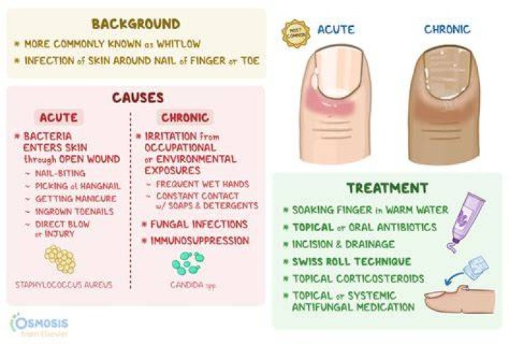 Can Raynauds affect nail growth