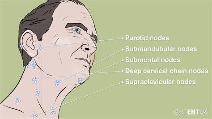 What is considered an enlarged axillary lymph node